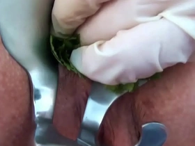 Nettles' anal play with a speculum for BDSM pleasure